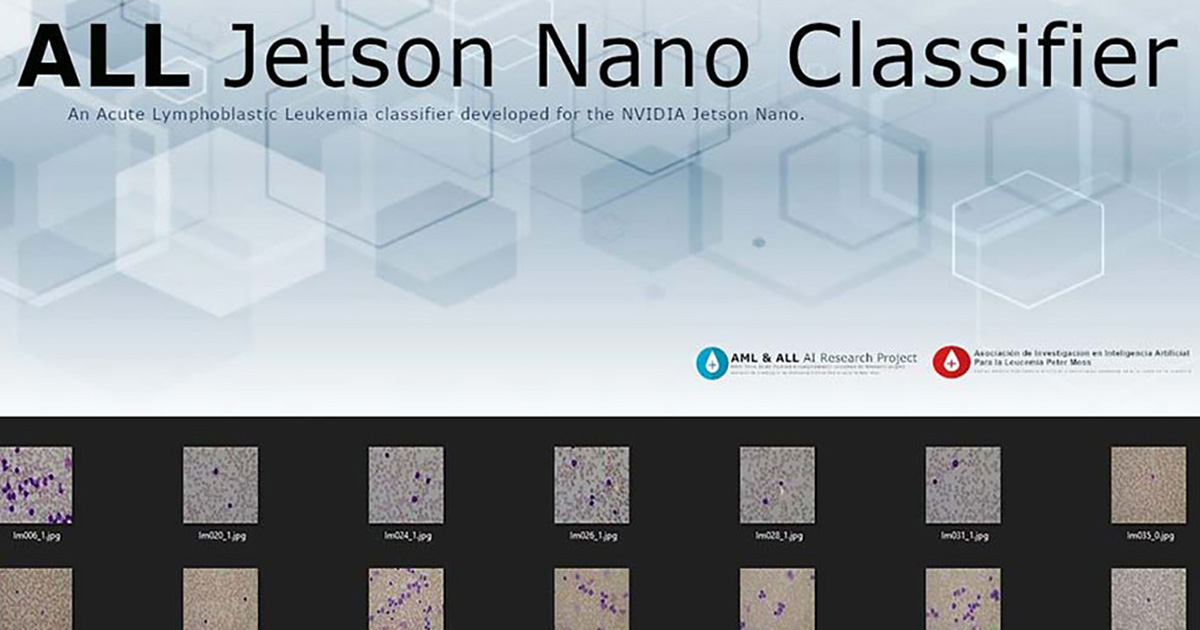 Detecting Acute Lymphoblastic Leukemia with NVIDIA Jetson Nano